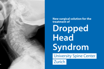 Radiograph of the neck of a patient with Dropped head syndrome.