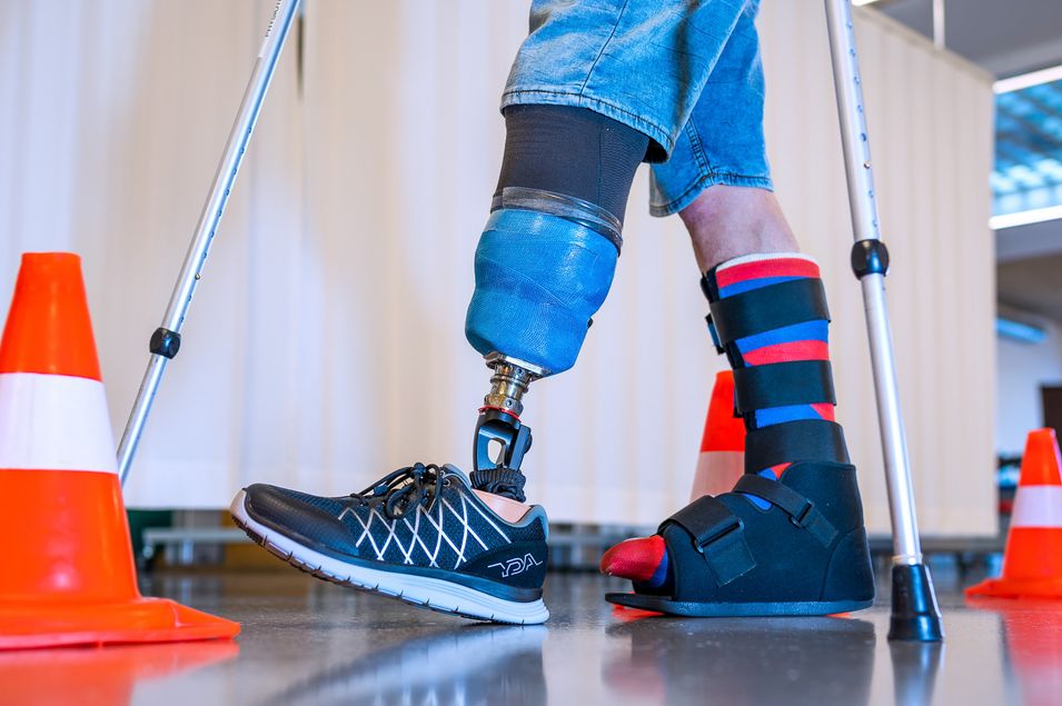 Close-up of a lower leg prosthesis. The patient is walking on flat ground with sticks.