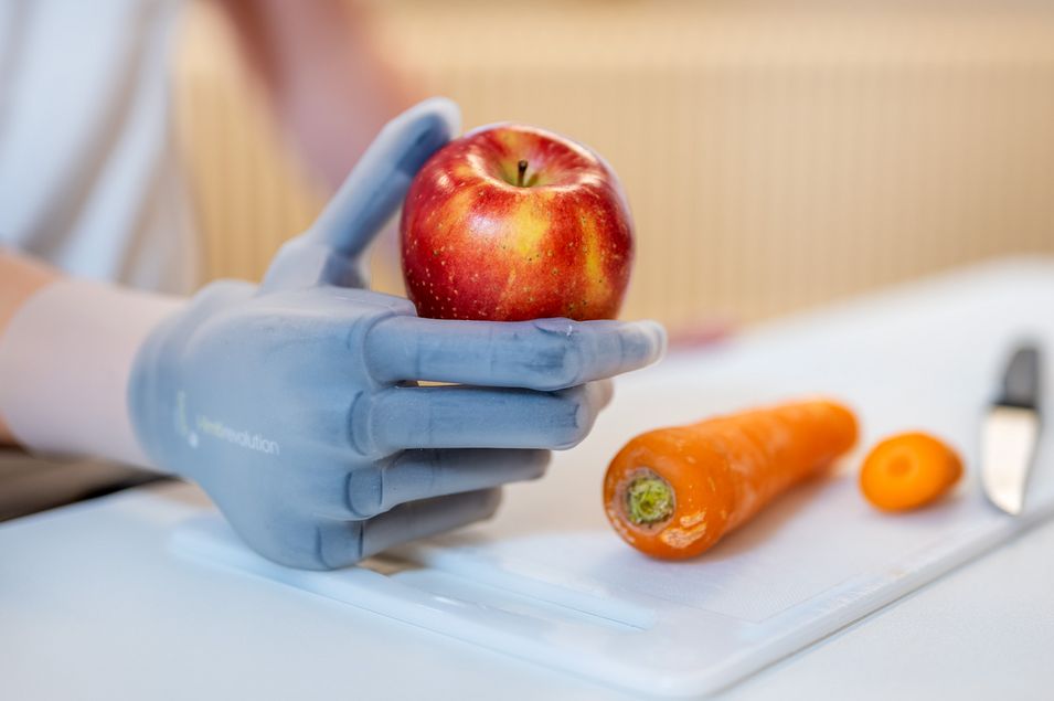 A man holds an apple with his prosthetic hand.