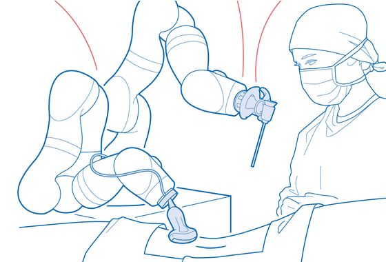 Zeichnung einer Person die mit Hilfe eines Roboterarms operiert.