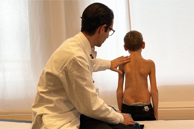 Ein Wirbelsäulenarzt untersucht den Rücken des Patienten nach der Skolioseoperation.