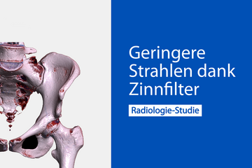 Computertomographie Hüfte und Becken