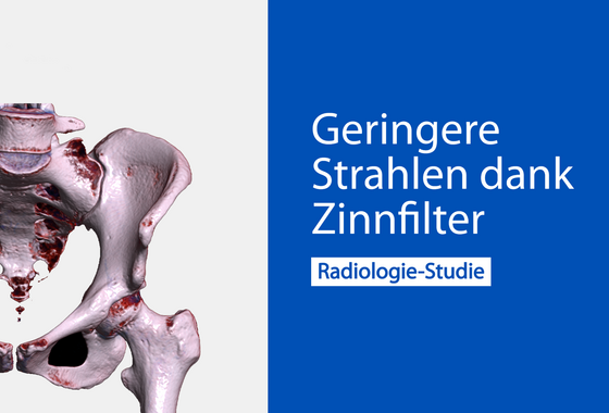 Computertomographie Hüfte und Becken