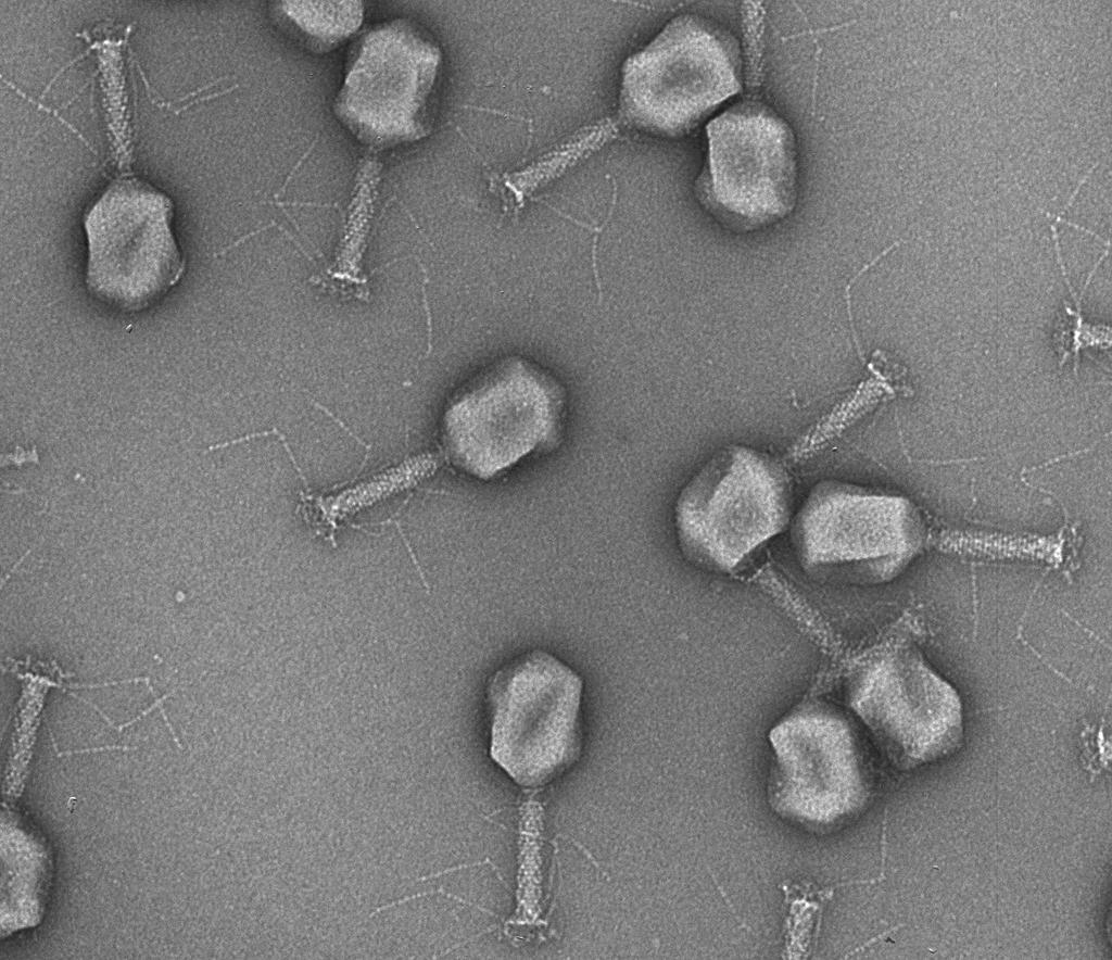 Elektronenmikroskopaufnahme von Phagen.