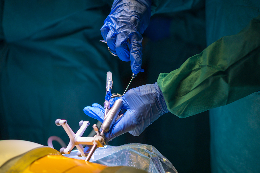 Endoskopische Wirbelsäulenchirurgie: Weniger Schmerzen, schneller fit