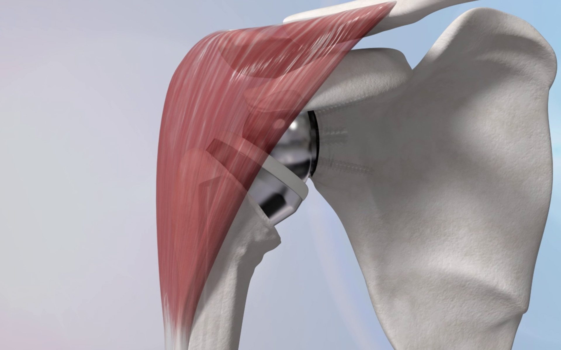 Balgrist International Shoulder Course 2019 Balgrist International Shoulder Course 2019