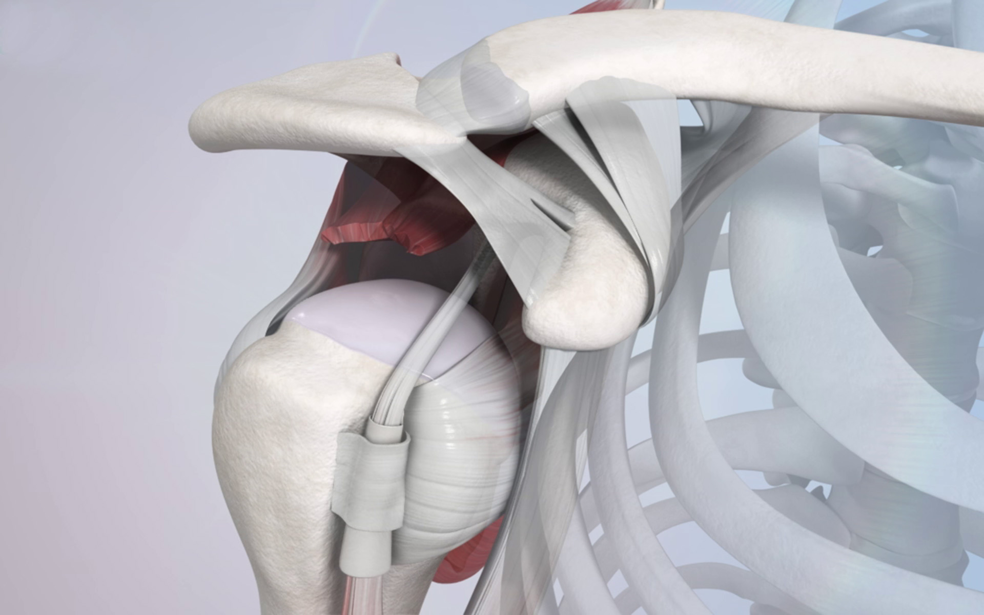Balgrist International Shoulder Course 2019 Balgrist International Shoulder Course 2019