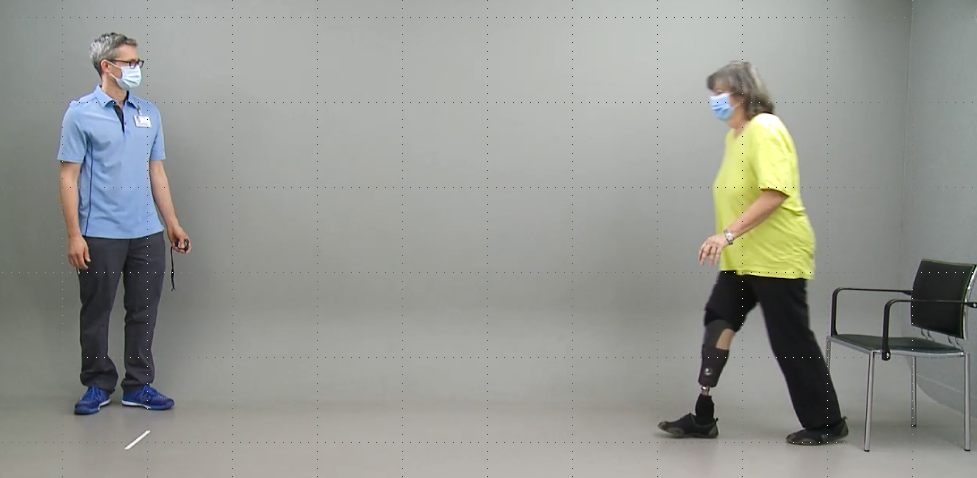Patientin läuft mit einer Unterschenkelprothese am rechten Bein auf den Therapeuten zu.