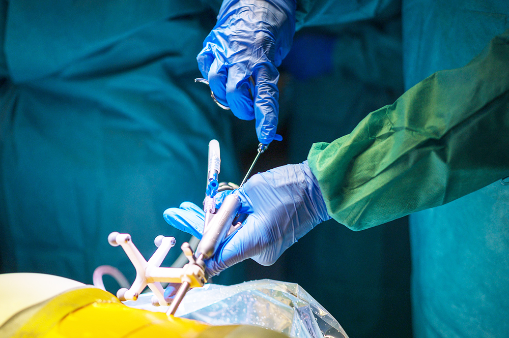 Endoskopisceh Wirbelsäulenchirurgie - weniger Schmerzen, schneller fit
