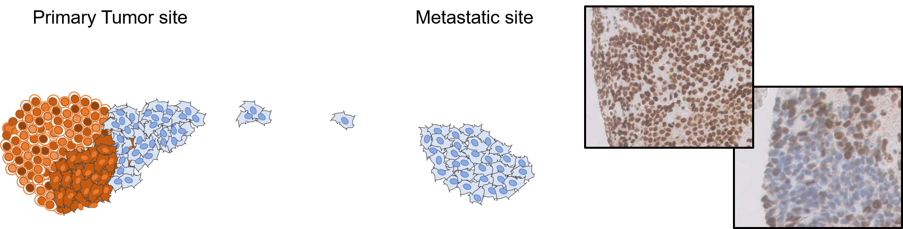 Graphical representation of tumor cells in different stages of mutation.