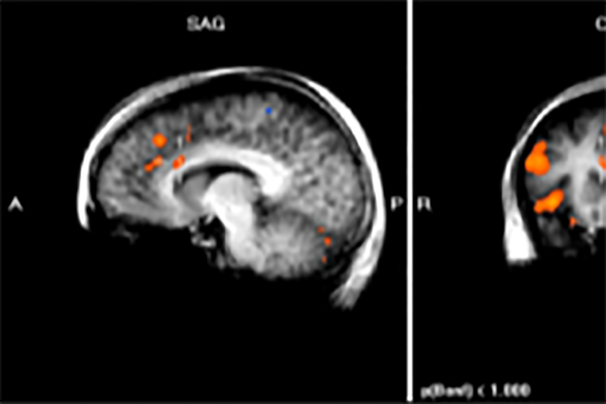 Balgrist Research Paraplegia