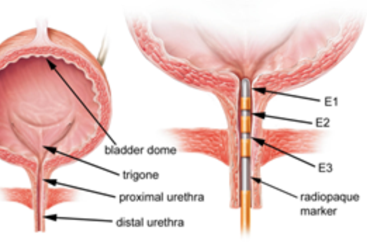 Balgrist Research Bladder Function