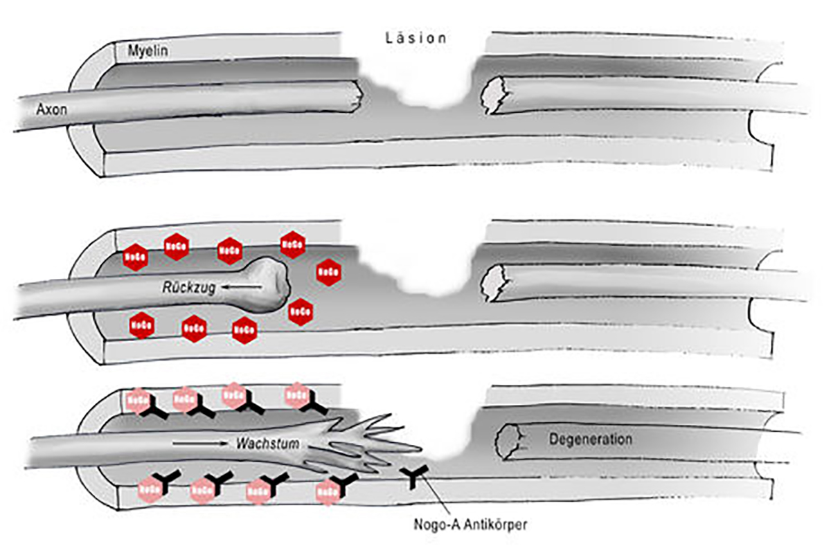 Balgrist Research Paraplegia