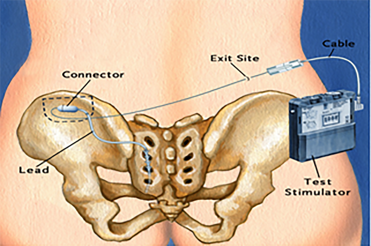 Balgrist Research Paraplegia