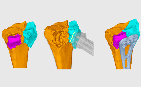 Identification of the bone fragments 